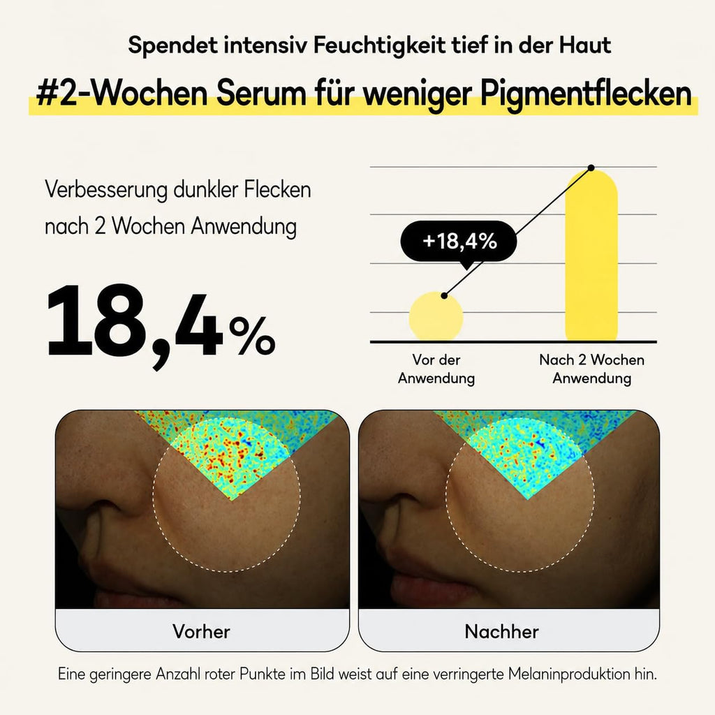 Bouncy Boost Serum – Niacinamid, Alpha Arbutin & Vitamin C für dunkle Flecken, ungleichmäßigen Ton & Ausstrahlung, 30 ml Niacinamid