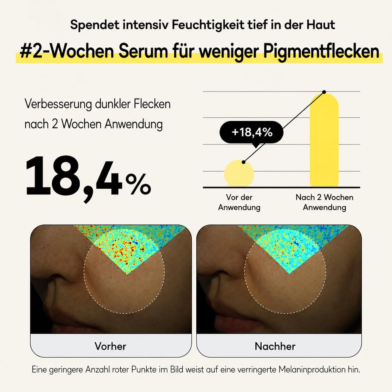 Bouncy Boost Serum – Niacinamid, Alpha Arbutin & Vitamin C für dunkle Flecken, ungleichmäßigen Ton & Ausstrahlung, 30 ml Niacinamid