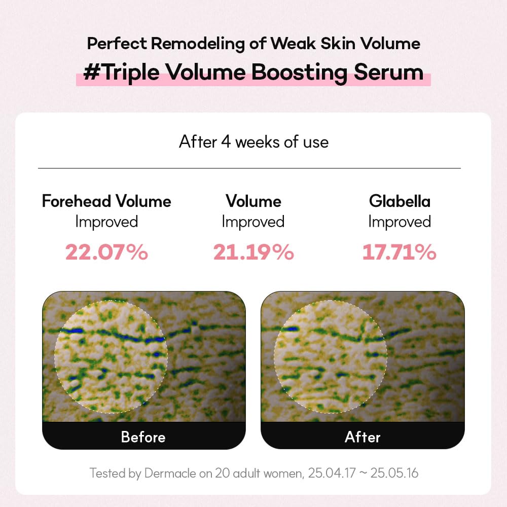 PDRN-Serum für straffe Haut | Formel mit ultraniedrigem Molekulargewicht (≤80 bp) | Für ein glattes Hautbild | Mit Kollagen, Bakuchiol und Retinol (30 ml) | Made in Korea